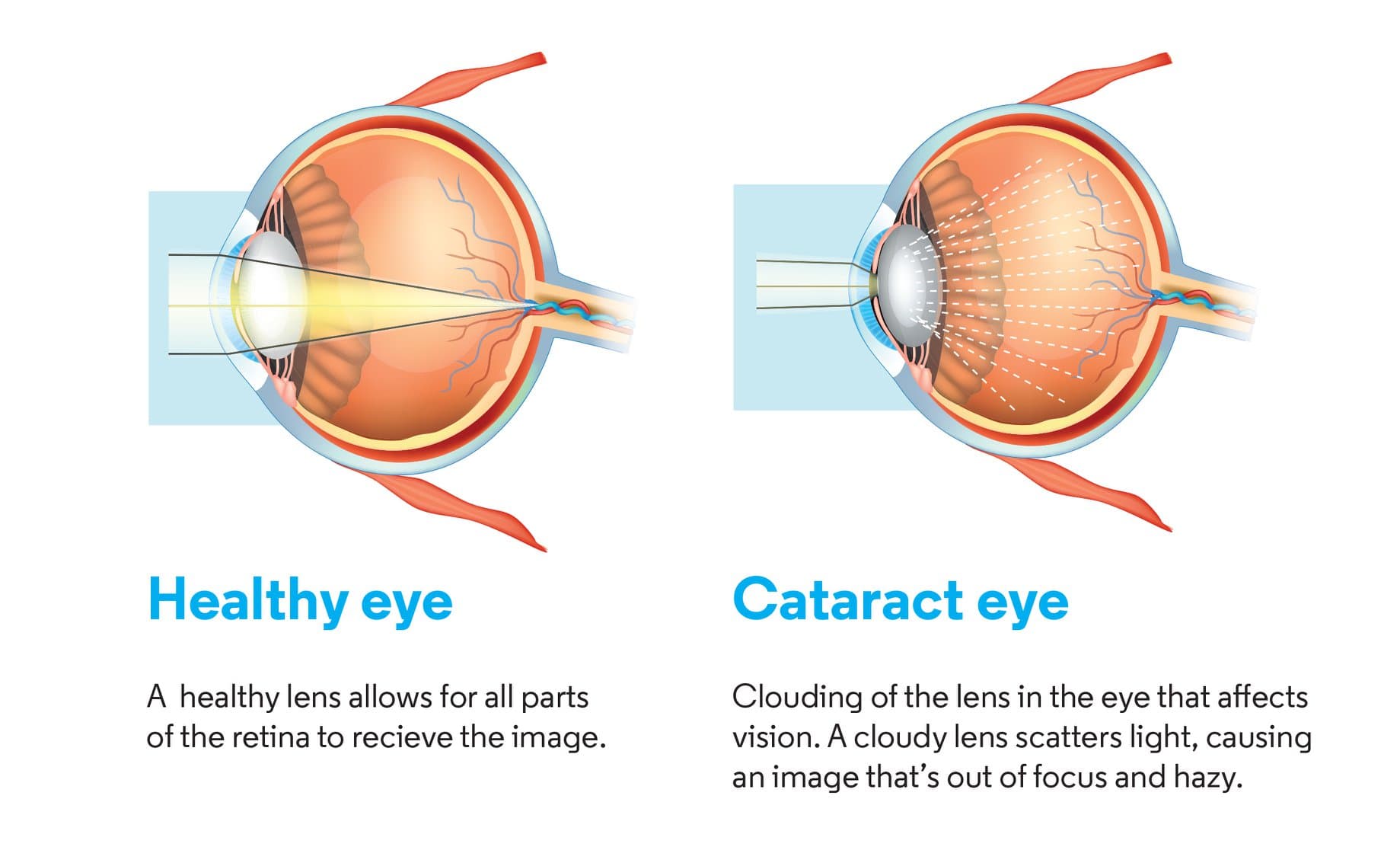 Optical Express social media campaign post 1